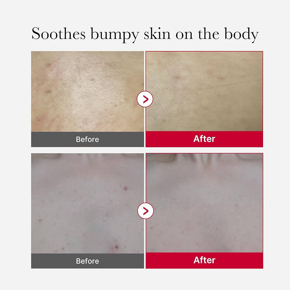 medicube Red Body Peeling Shot Cleanser