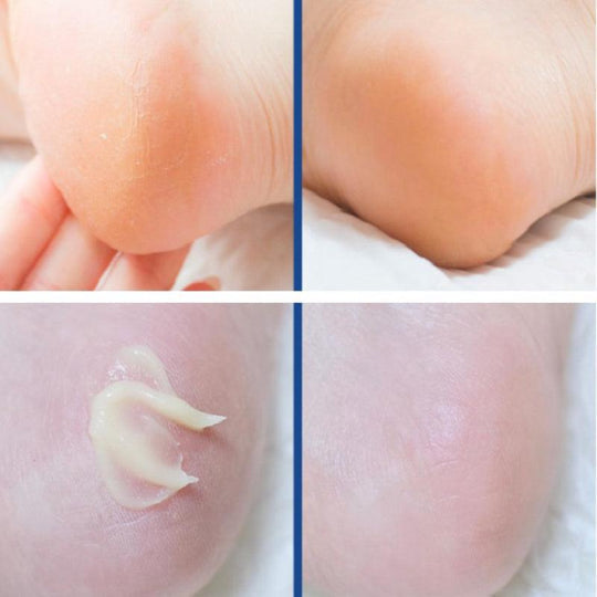 MEDI-PEEL EGF Scaling Moisture Foot Cream