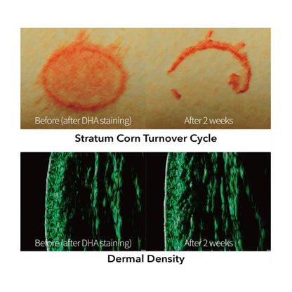 REJURAN® Turnover Ampoule, c-PDRN® – Original Salmon DNA PDRN Face Serum