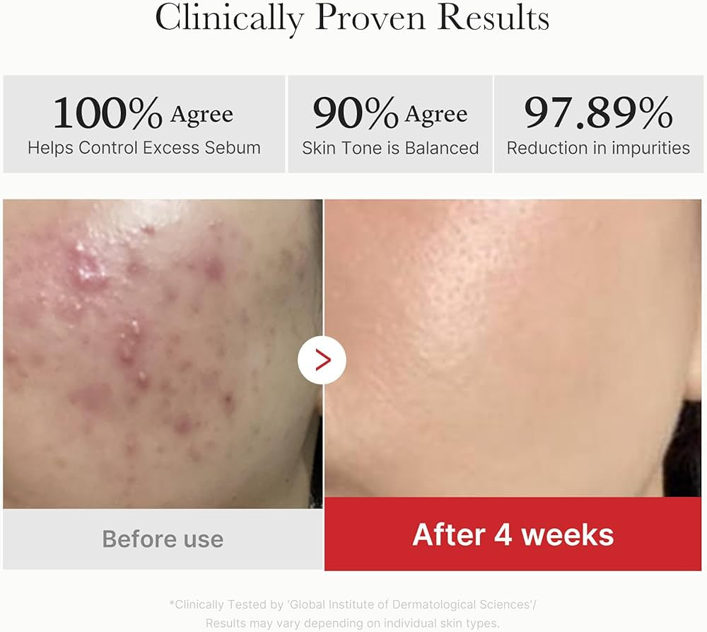 medicube Red Succinic Acid Peeling Pad