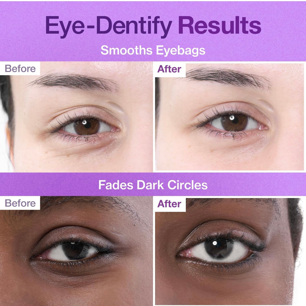 numbuzin No.9 NAD+ Collagen Under Eye Patches