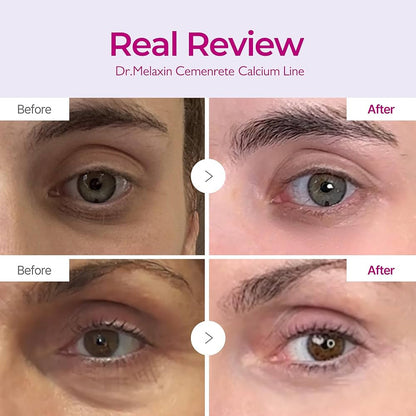 Dr. Melaxin Cemenrete
Calcium Volume Cream