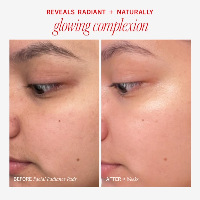 First Aid Beauty Facial Radiance Pads with Glycolic + Lactic Acids