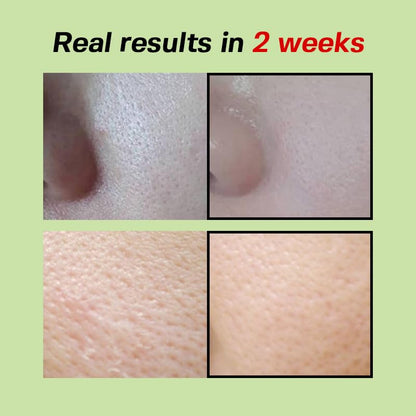 SUNGBOON EDITOR Green Tomato Pore Lifting Ampoule+