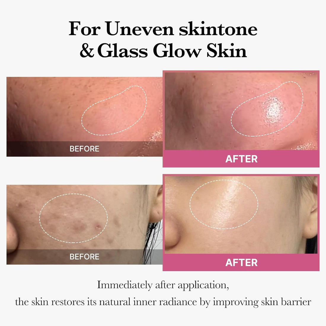 forensia collagen & glutathione ampoule cream 3 for sgd50 forensia collagen & glutathione ampoule cream 3 for sgd50