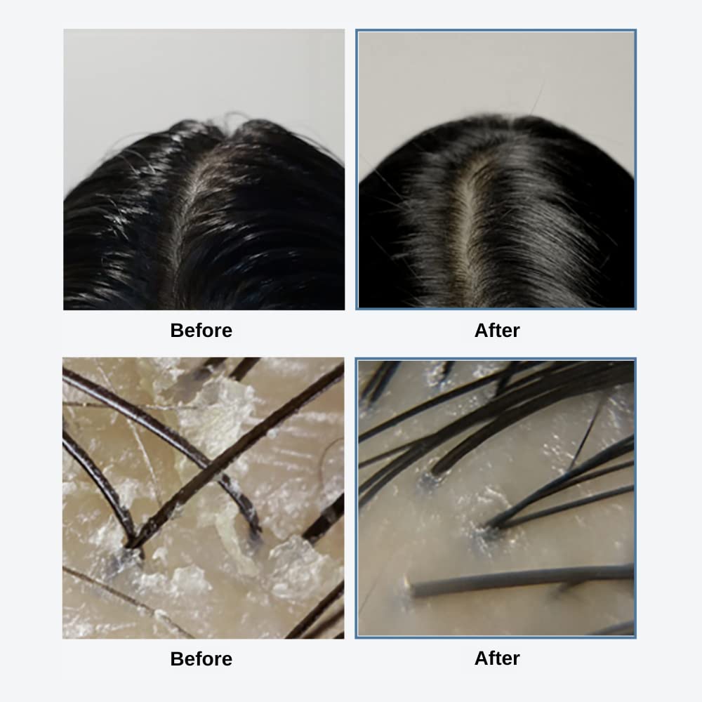 GROWUS - Sea Salt Therapy Scalp Scaler
