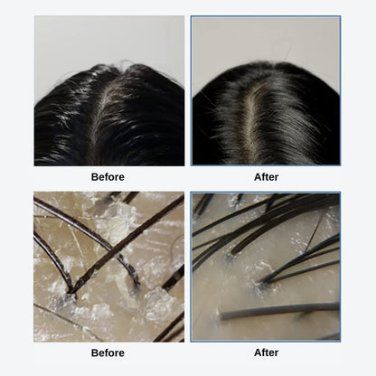 GROWUS - Sea Salt Therapy Scalp Scaler