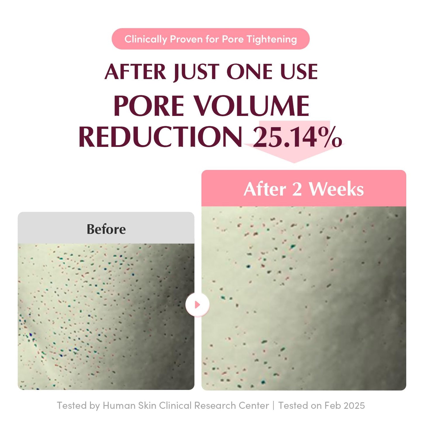 EQQUALBERRY - Collagen Pore-tight up Hydrogel Mask Set
