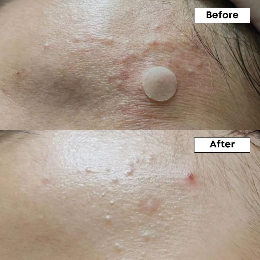 NINELESS - A-Control 10% Azelaic Acid Serum