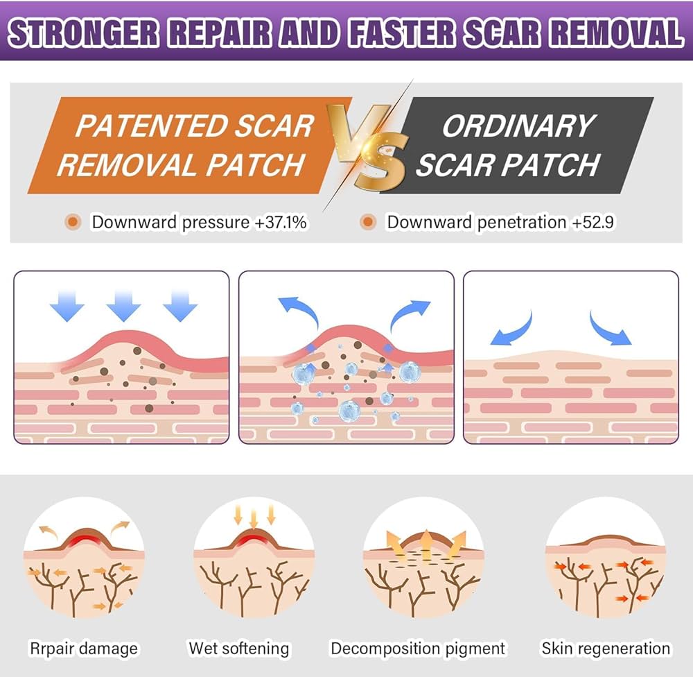 Silicone Scar Tape for Surgical Scars