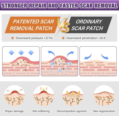 Silicone Scar Tape for Surgical Scars