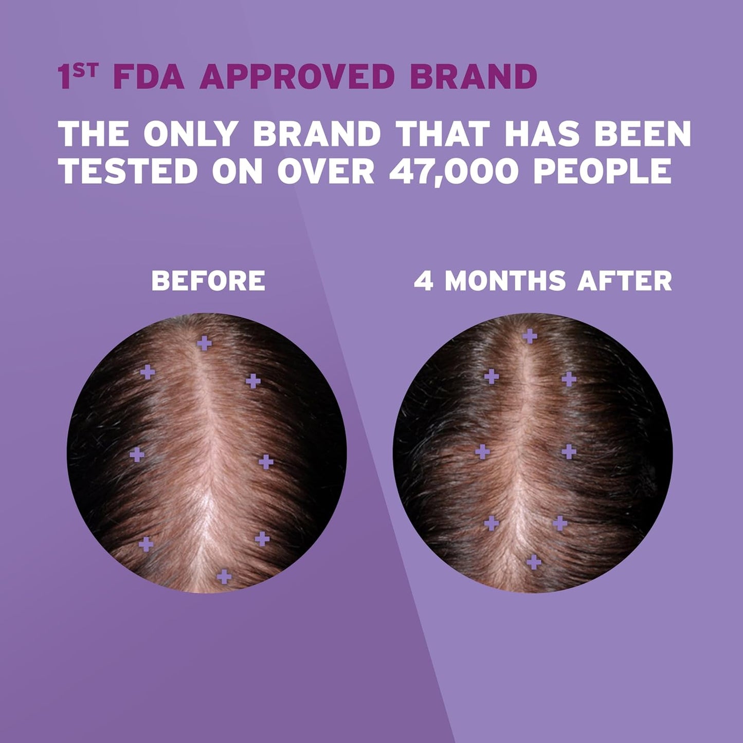 Women's Rogaine 2% Minoxidil Topical Solution