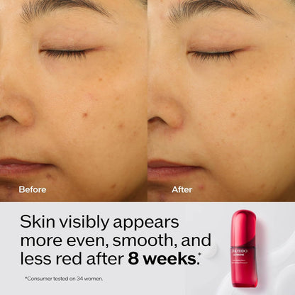 Shiseido Ultimune Power Infusing Serum