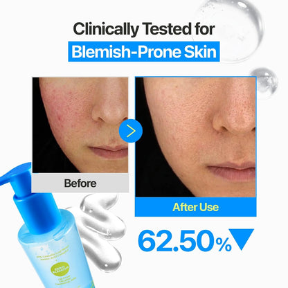 numbuzin Zero Blemish Oil-Free Micellar Cleansing Jelly