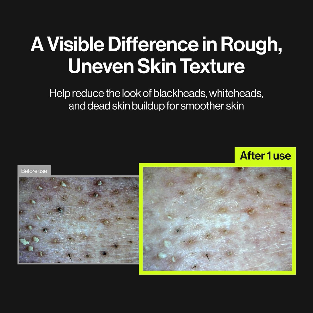 UNLEASHIA Two Step Zero Pore Overnight Bubble Mask