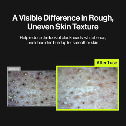 UNLEASHIA Two Step Zero Pore Overnight Bubble Mask