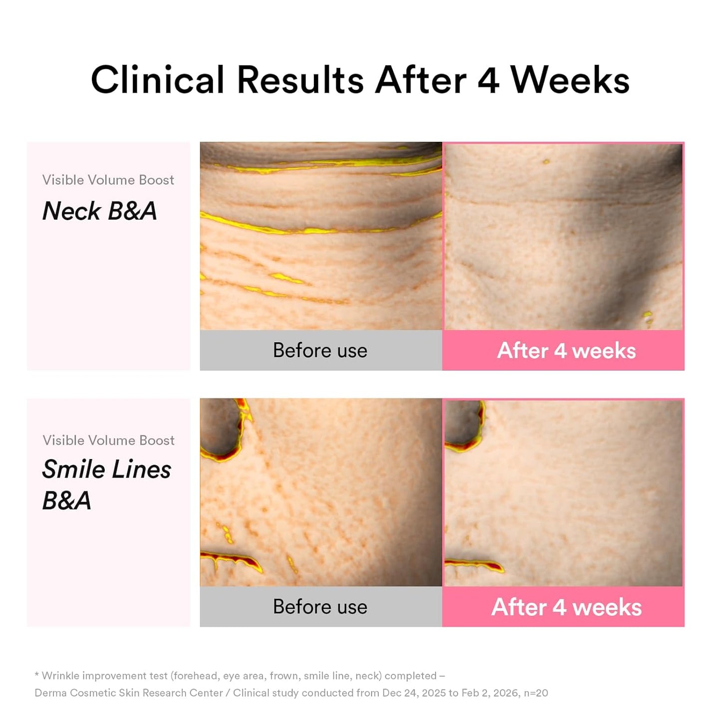 Abib PDRN Volume Fill-it Booster Crème 2.5 Tube
