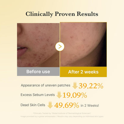 medicube Kojic Acid Turmeric Pad