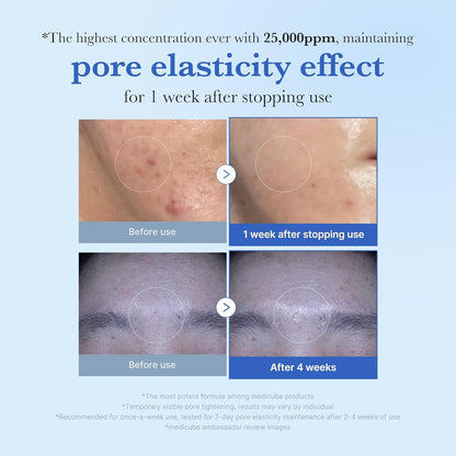 medicube - One Day Exosome Shot Pore Ampoule 25000