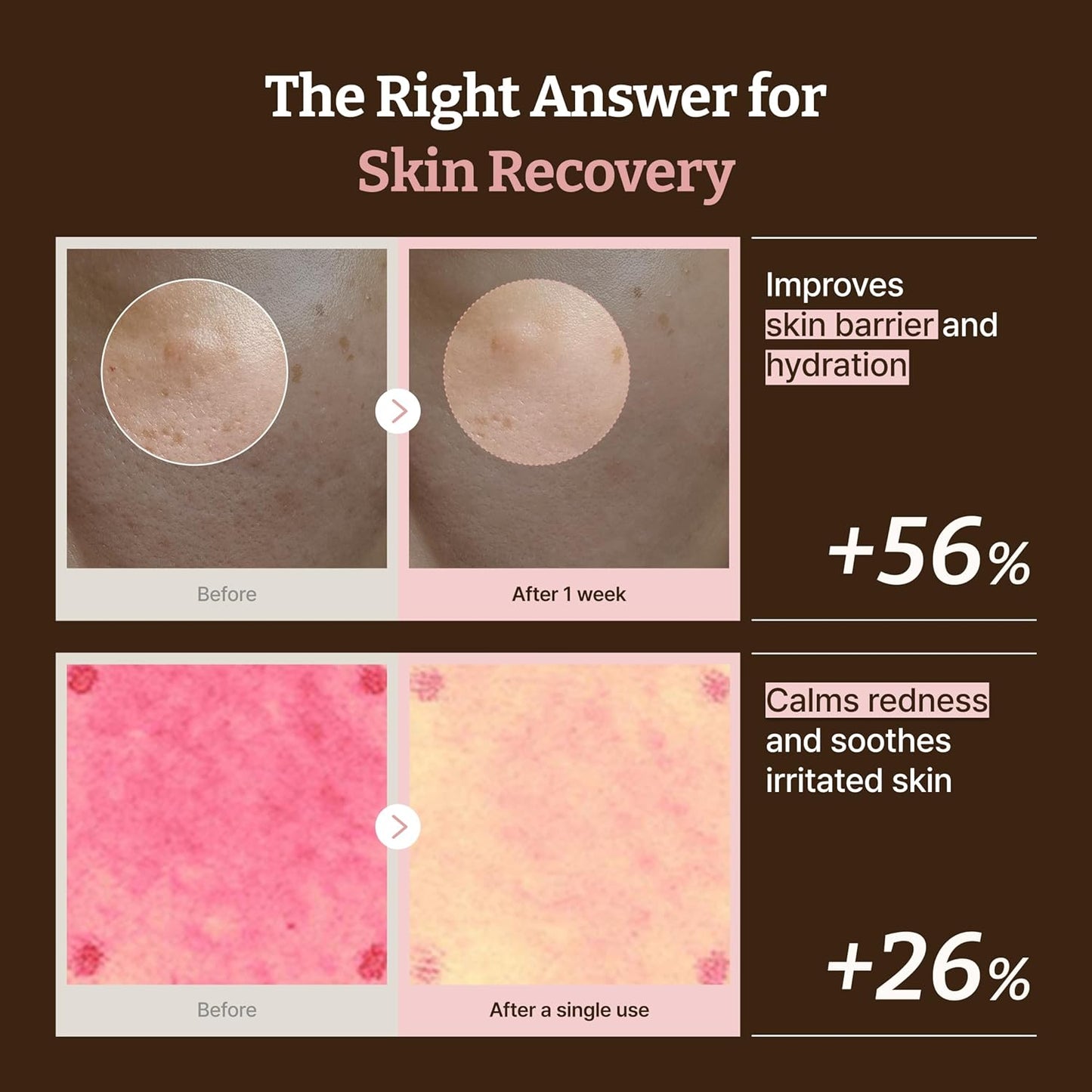 Dr.Reju-All Advanced PDRN Rejuvenating Cream