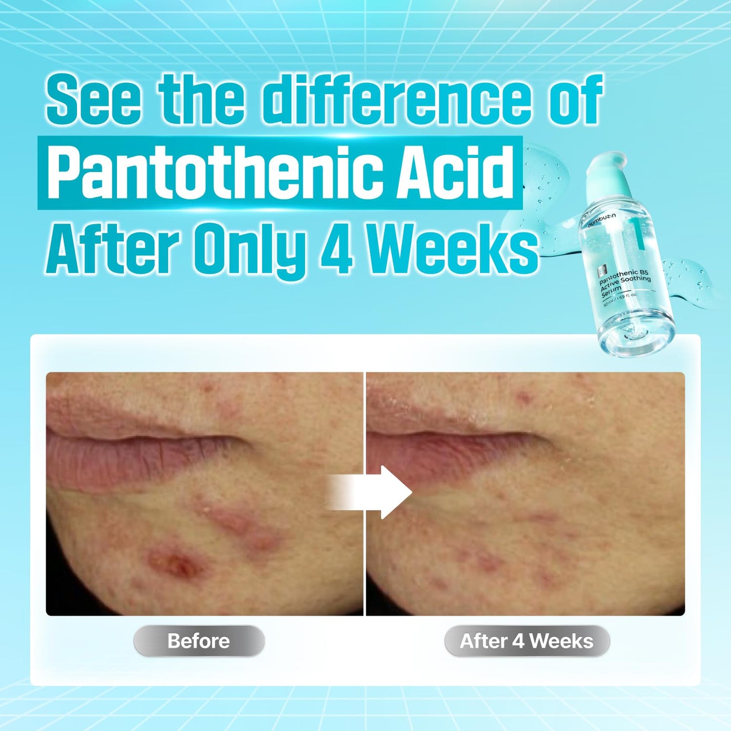 numbuzin No.1 Pantothenic B5 Active Soothing Serum