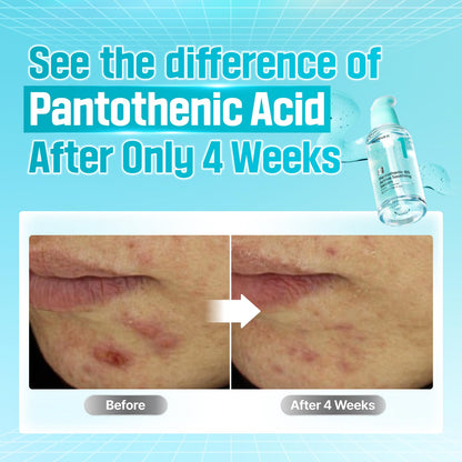 numbuzin No.1 Pantothenic B5 Active Soothing Serum