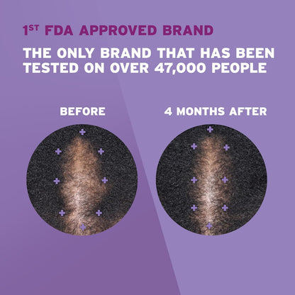 Rogaine for Women 5% Minoxidil Foam - 4 Months Supply