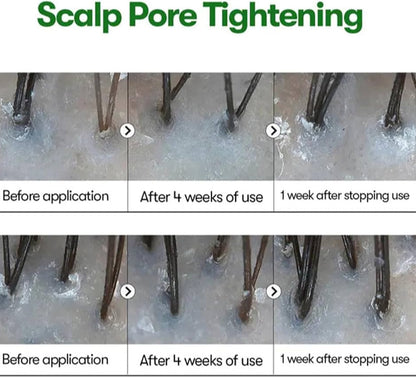 VT PDRN Reedle Shot Hair Ampoule 100dL