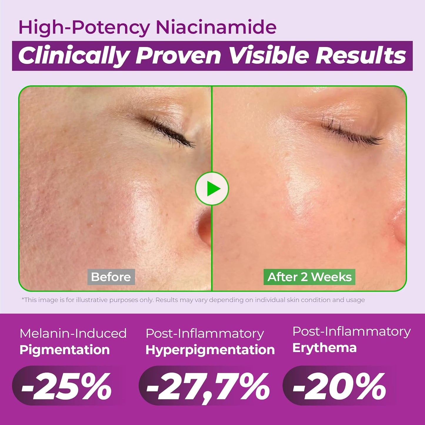 JUMISO Niacinamide 20 Serum