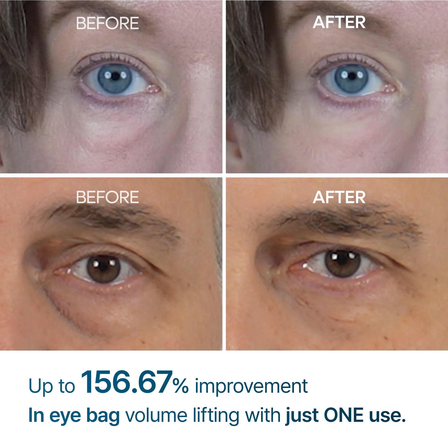 Dr.Melaxin Eyephalt
Eyebag Cream