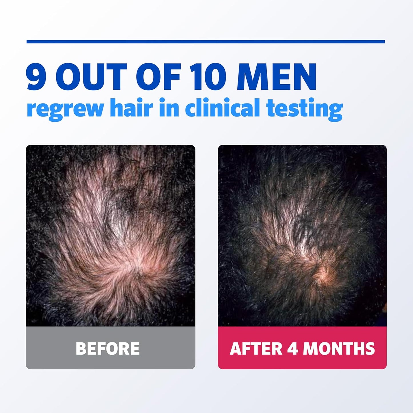 Men’s Rogaine 5% Minoxidil for Men Foam - 3 Months Supp