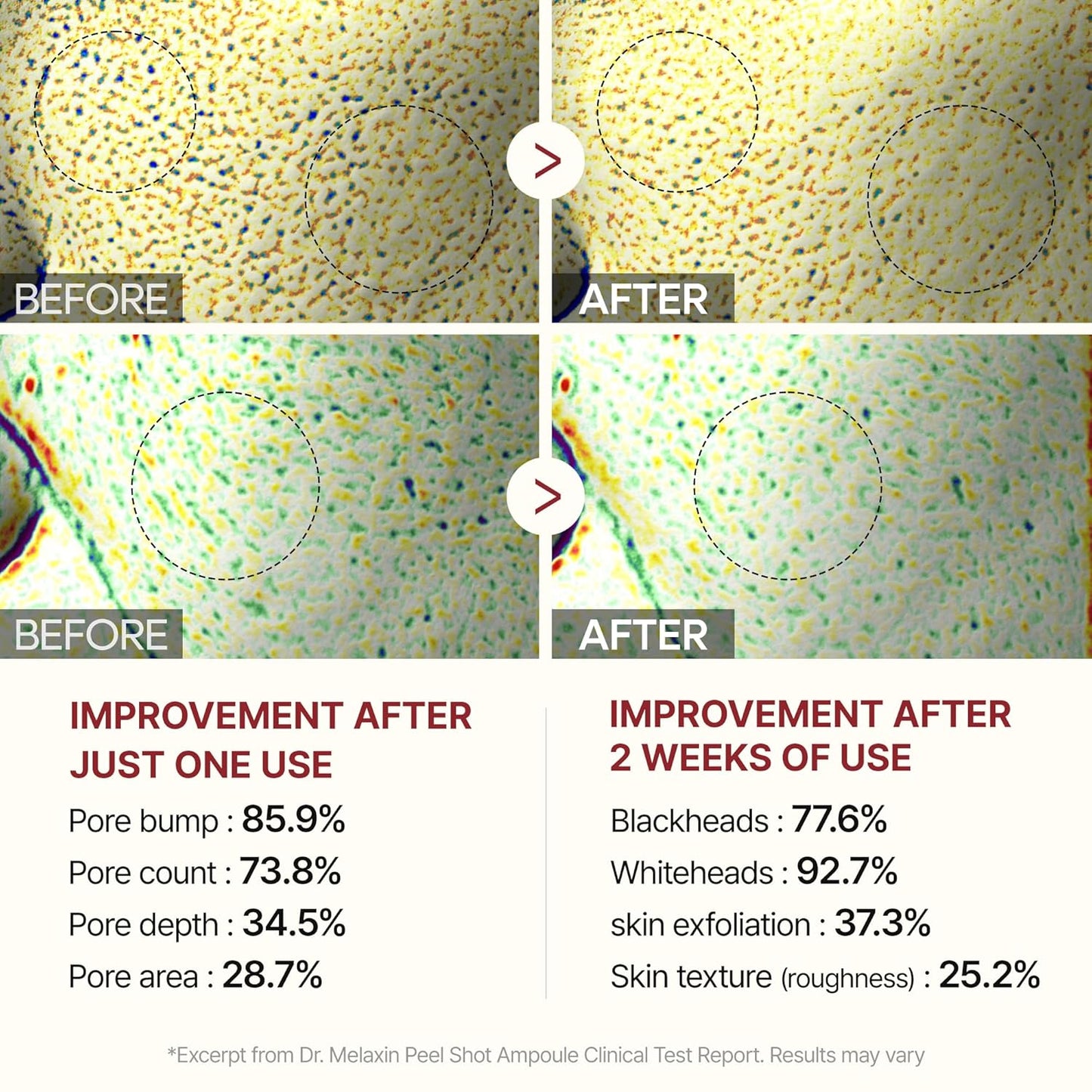 Dr.Melaxin Peel Shot Exfoliant Black Rice Ampoule