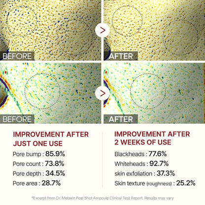 Dr.Melaxin Peel Shot Exfoliant Black Rice Ampoule