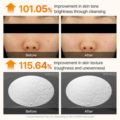 Dr.Melaxin Peel Shot Exfoliating Kojic Acid Turmeric Serum