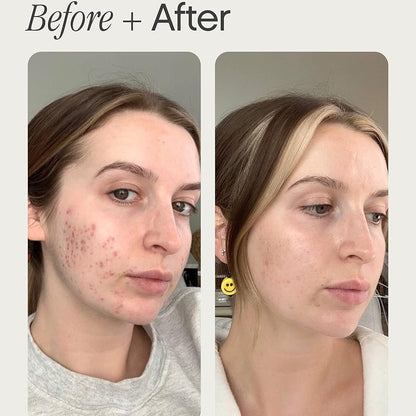 Topicals - Faded Brightening and Clearing Serum