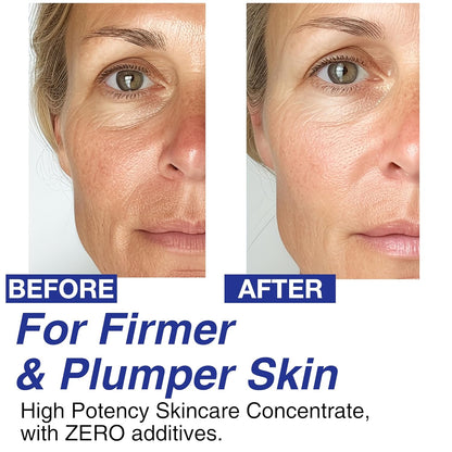 CELDYQUE Volufiline 100%