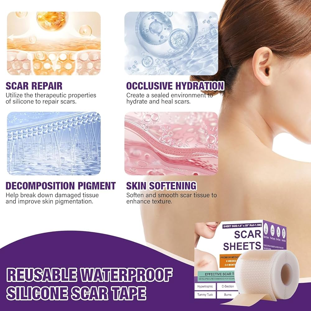 Silicone Scar Tape for Surgical Scars