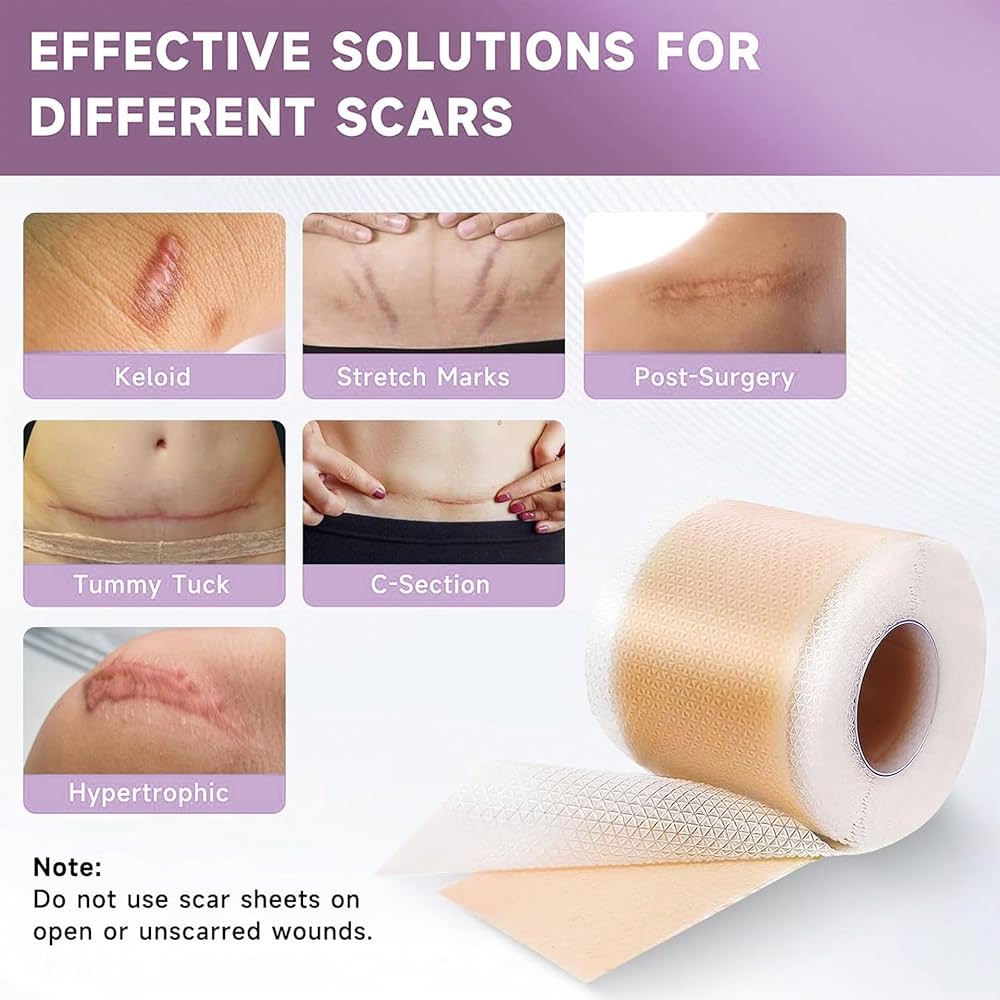 Silicone Scar Tape for Surgical Scars