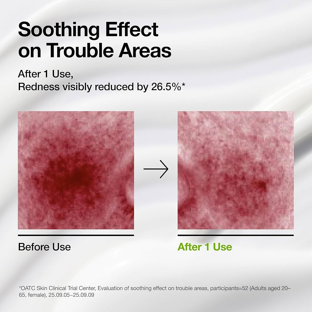 Anua Azelaic Acid Cica Skin Soothing Moisturizer