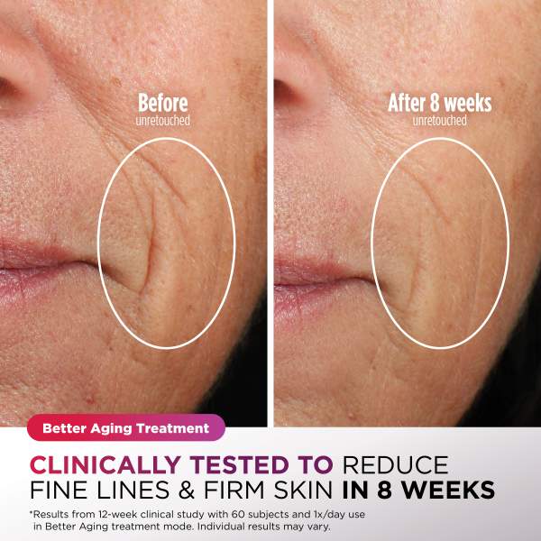 Shark™ CryoGlow™ Red Blue & Infrared iQLED Face Mask & Under Eye Cooling