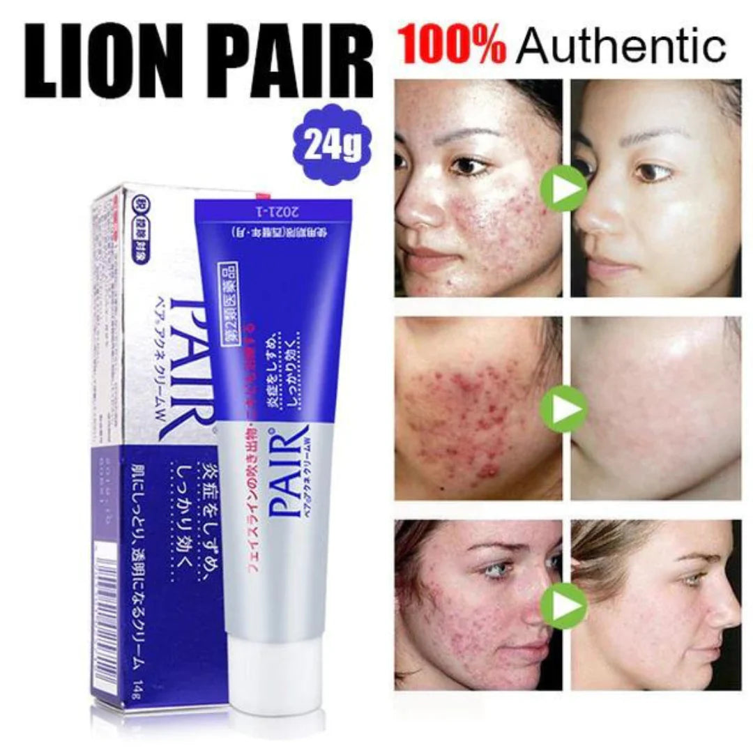 LION Pair Acne Cream W Radiantly lion-pair-acne-cream-w-radiantly